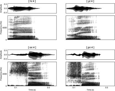 Extracting Phonetic Features From Natural Classes: A Mismatch Negativity Study of Mandarin Chinese Retroflex Consonants
